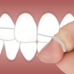 Benefits of Flossing Your Teeth