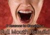 6 Signs It Might Be Time to Consider Full Mouth Reconstruction 6 Reasons to Consider a Full Mouth Rebuild