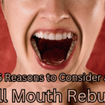 6 Reasons to Consider a Full Mouth Rebuild