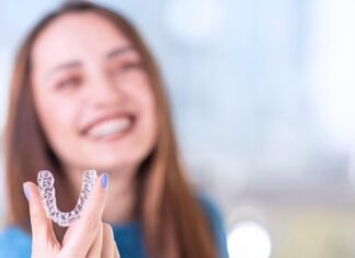 Clear Aligners