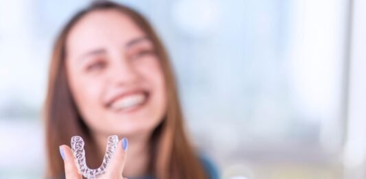 Clear Aligners
