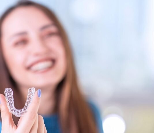 Clear Aligners